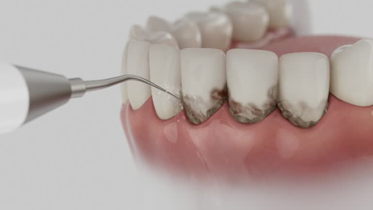 Trusted Root Canal Treatment service in Marissa, IL - Dentist Open Now